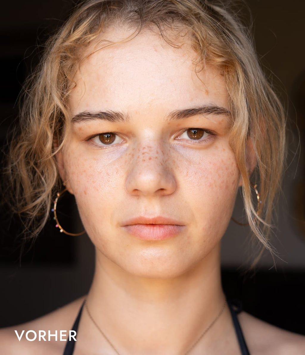 Summer Sale Set 1 Vorher