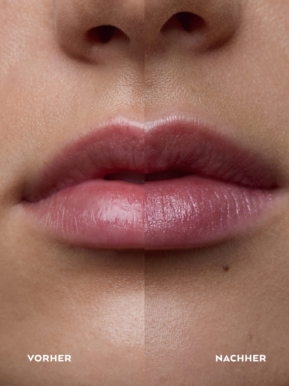 Vergleichsbild Tagarot Balm 03 ohne und mit